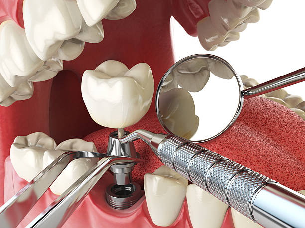 Best Emergency Dentist for Knocked-Out Tooth in Kodi, AK